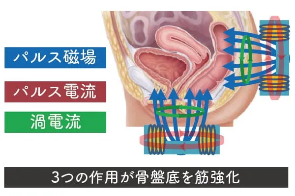 スターフォーマーの特徴